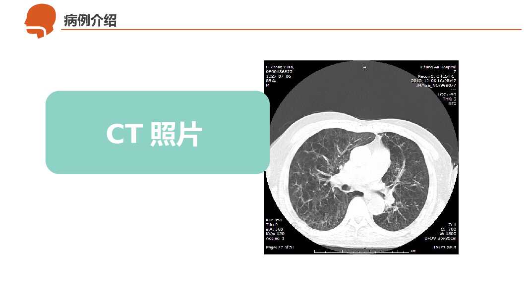 呼吸衰竭护理治疗病例PPT模板